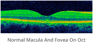 normal-macula-and-fovea-on-oct