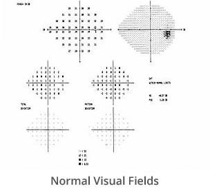 normal-visual-fields