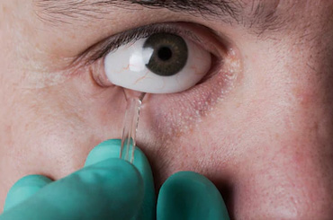 ocular-prosthesis-clinic-gurgaon